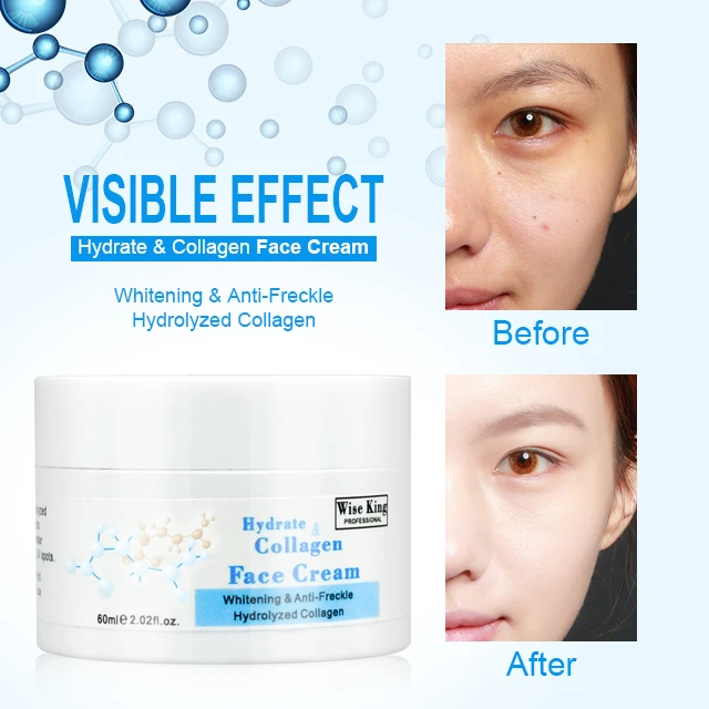 Best WISEKING whitening beauty face cream for skin care and anti-Freckle with collagen and argan oil