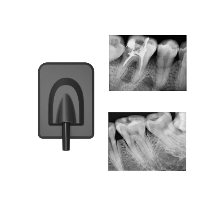 
Factory Price Medical Digital Dental X ray Intraoral Clinic X-ray Sensor 