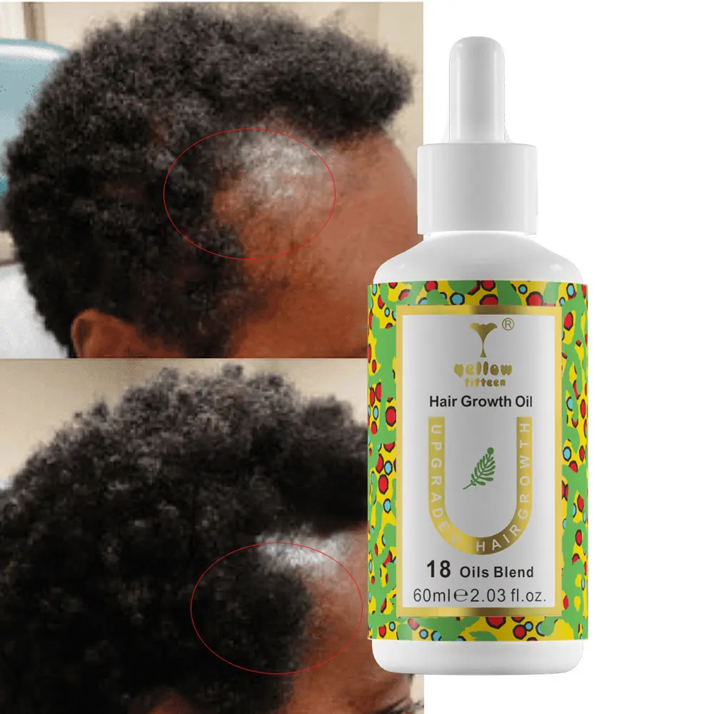 OEM Batana oil Oil for Hair Care Products Custom Dry Damage Hair Loss Treatment Biotin Growth Oils
