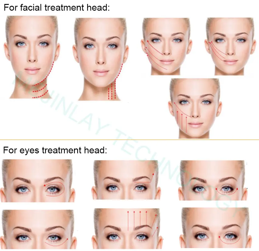 Mejinlay best selling product monopolar rf fat loss skin tightening  machine for face