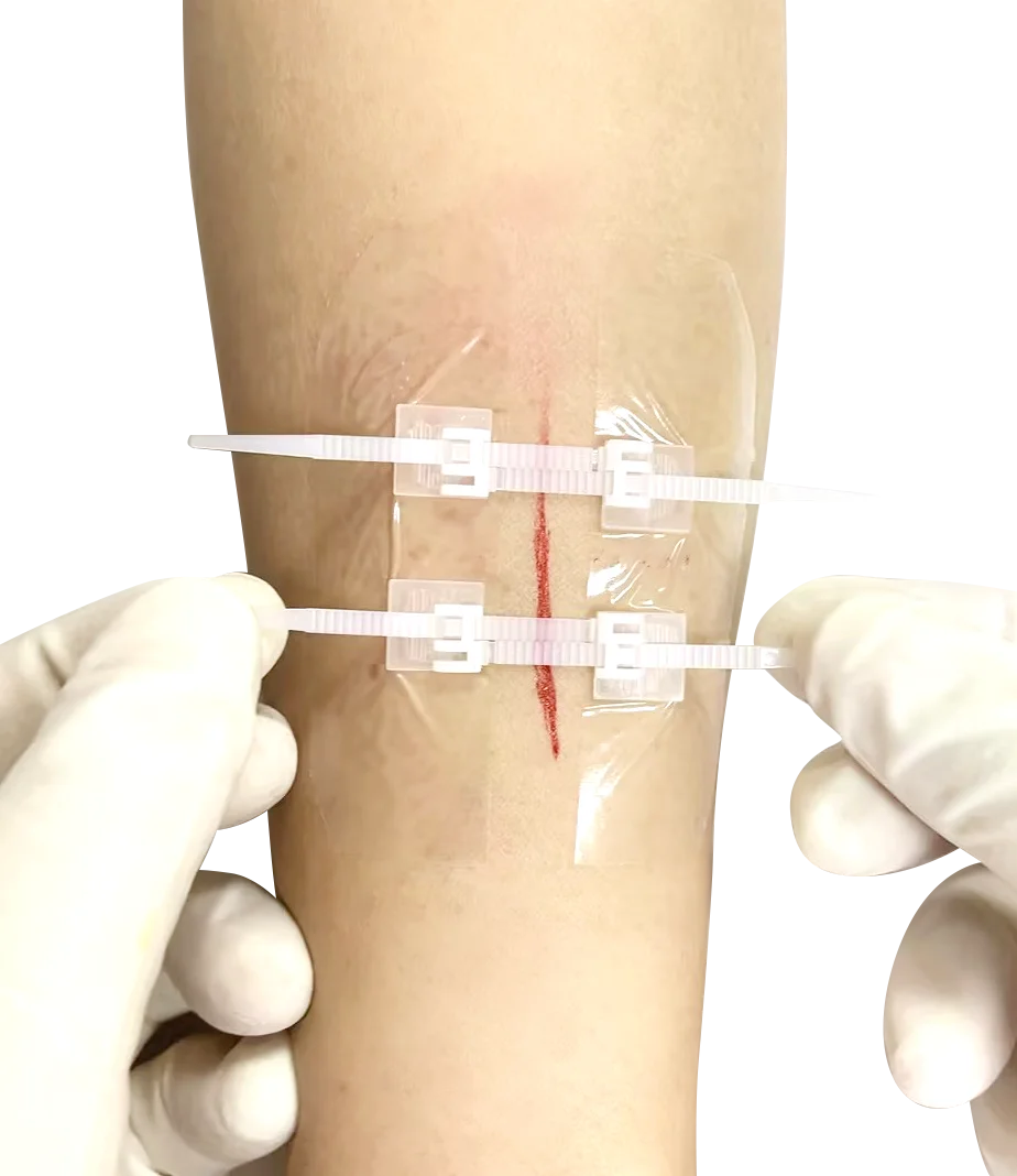 Extra Large Steri Strips Wound Closure Device, Waterproof Butterfly Wound Closure Strips