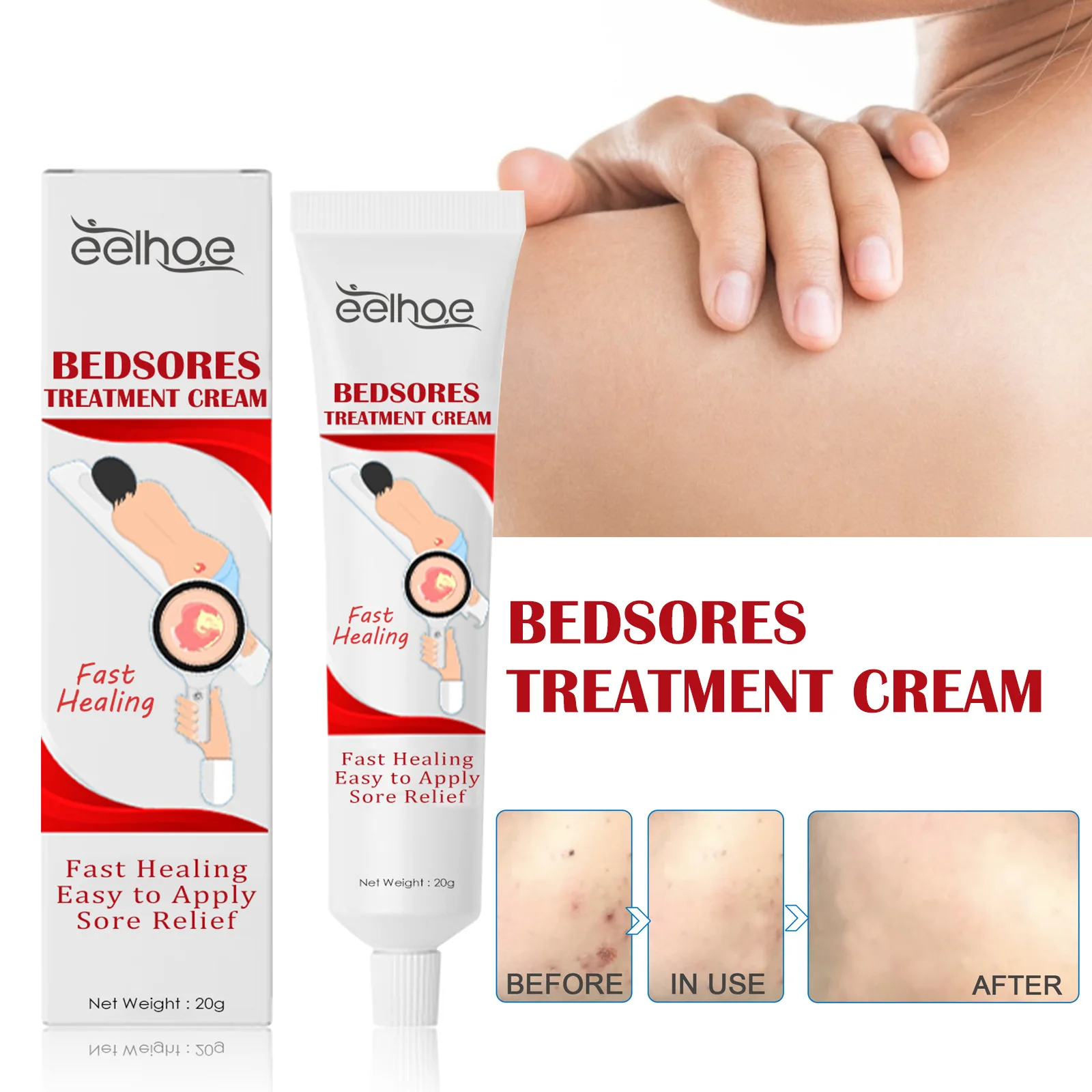 Private Label Fast Healing Bedsores Treatment Ointment Wound care Ointment Bedsores Cream Body Care Cream 20g
