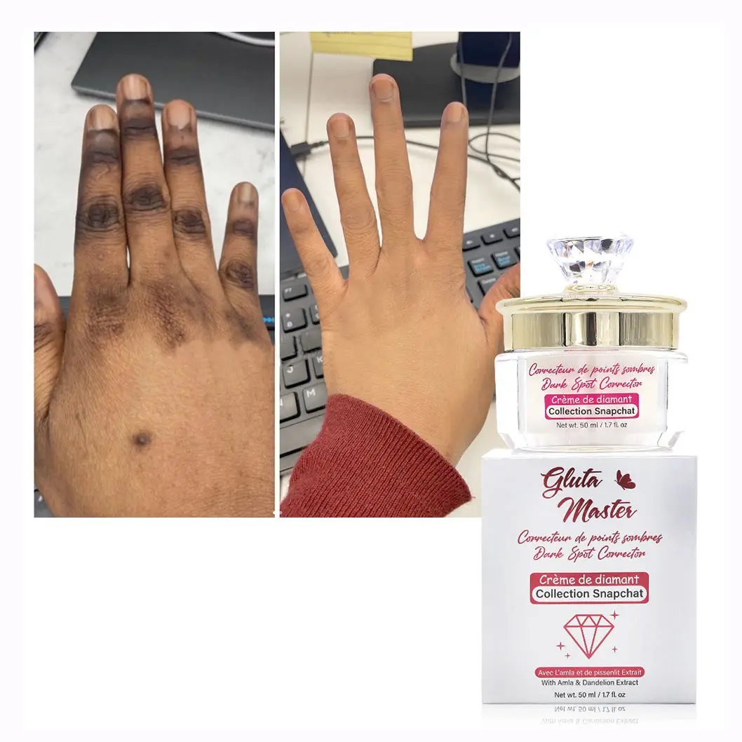 Diamond whitening face cream beauty Body Dark Spots Remove Face Cream Brightening Best Cream To Lighten The Skin Of The Face