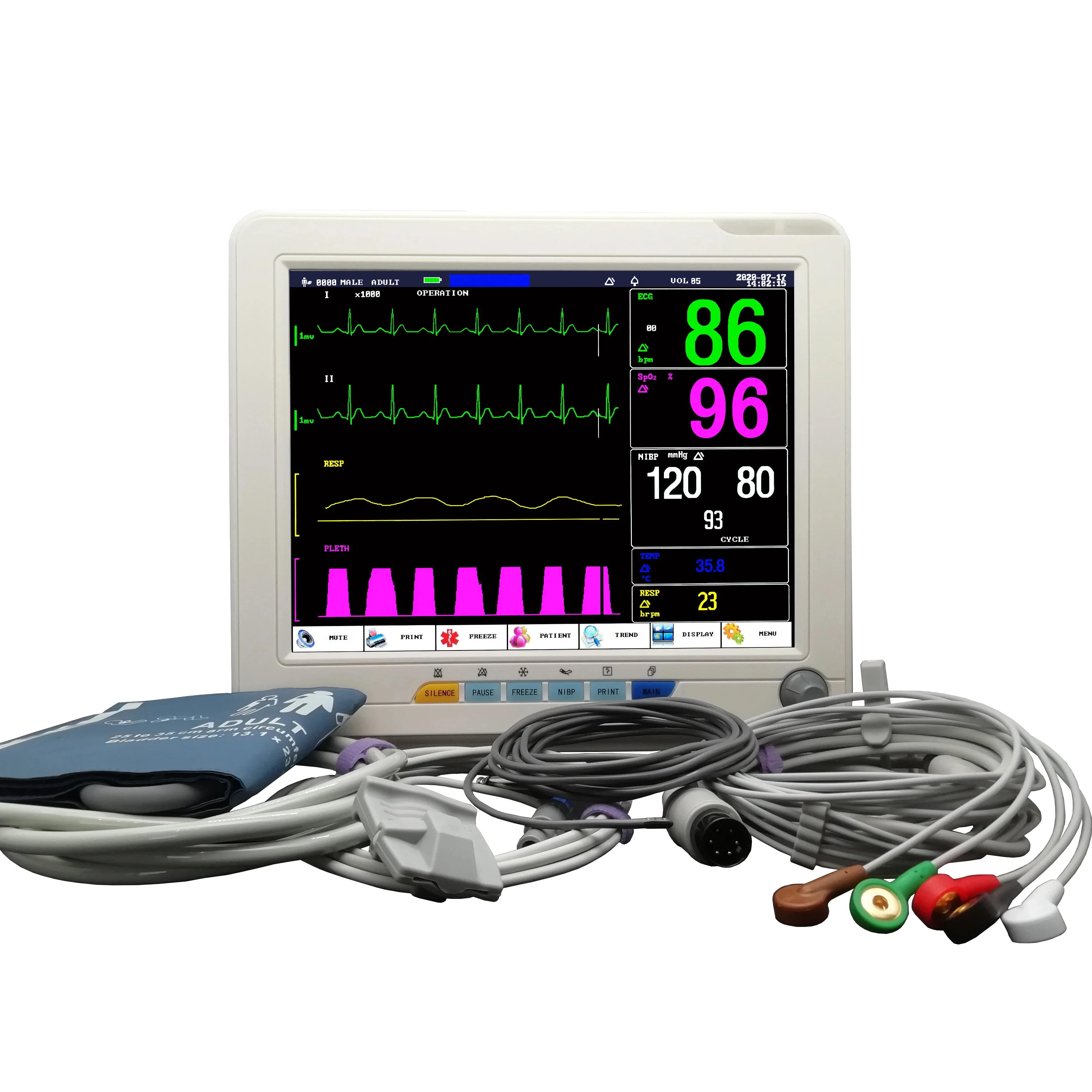 multi-parameter veterinary use equipment portable veterinary monitor with direct factory price