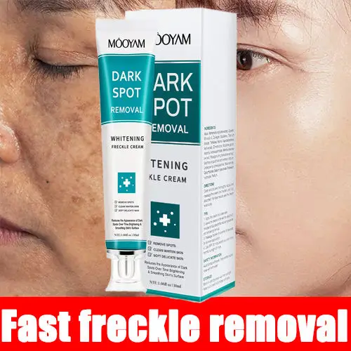 Hot Sale OEM Dark Spot Removal Cream Moisturizeing Brightens the Complexion 30g MOOYAM Whitening Dark Spot Removal Cream