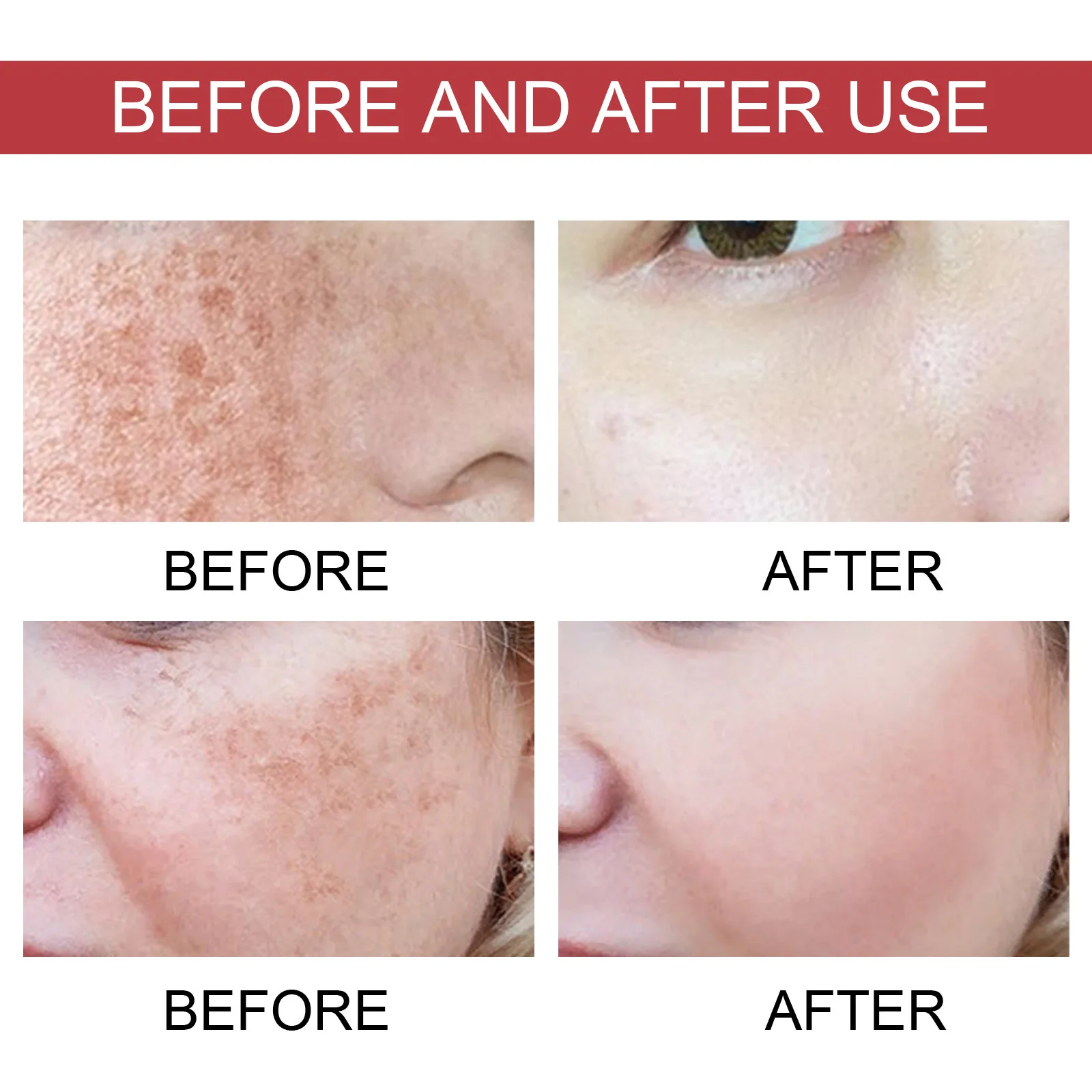 Private Label 10% Niacinamide 4% Tranexamic Acid Anti Dark Spot Brightening Facial Serum