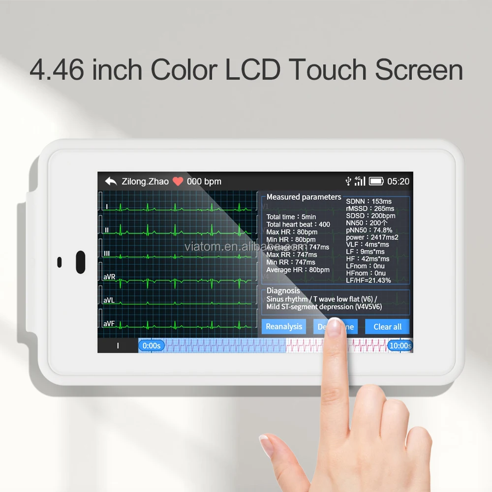 Wellue PCECG 500 24 Hours 12 Channel  ECG Device Electrocardiograma Wearables ECG