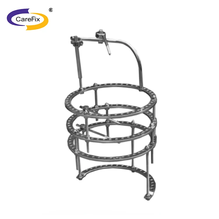 
Orthopedics trauma surgery external fixation bracket fracture internal fixation 
