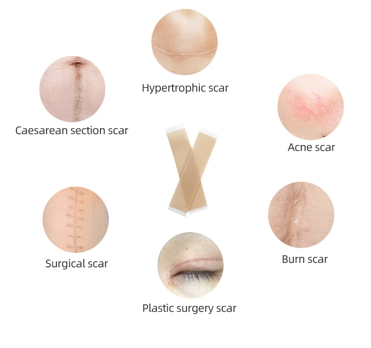 HODAFScar Silicone Gel Sheets Skin friendly adhesive scar removal Silicone Tape