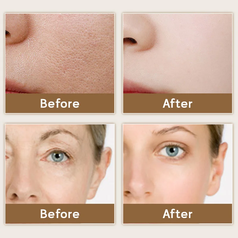 Resveratrol Niacin Hyaluronic Acid Anti-Oxidant Anti Wrinkle Serum