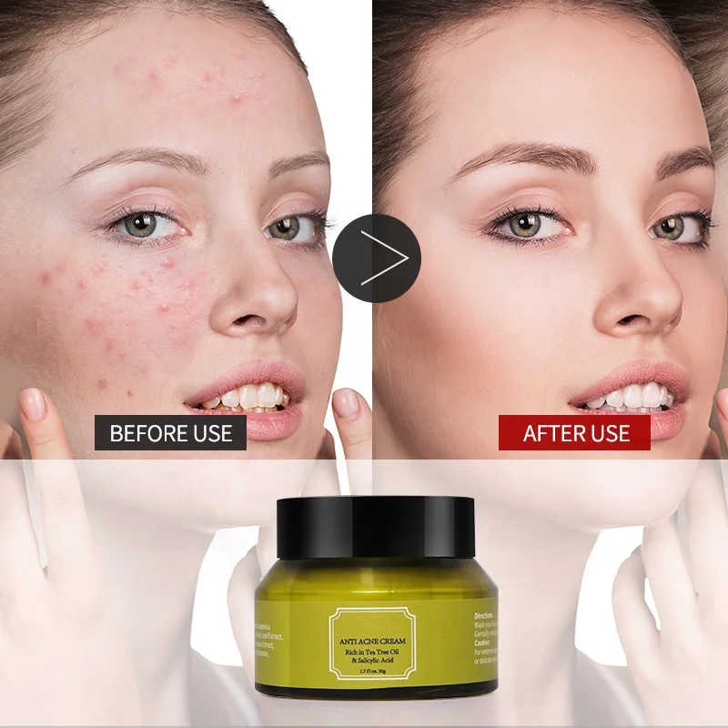 Tea Tree Oil Control Shrink Pores Acne Nourish Whitening Skin Care Face Cream
