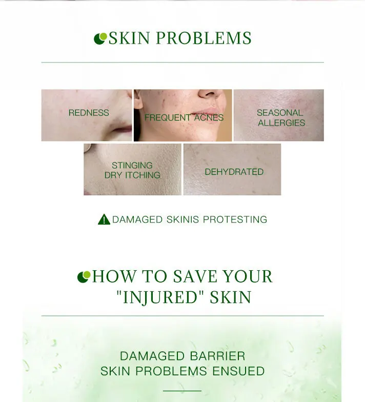 Aloe vera gel factory direct wholesale acne care skin moisturizing repair skin face use high purity aloe vera gel