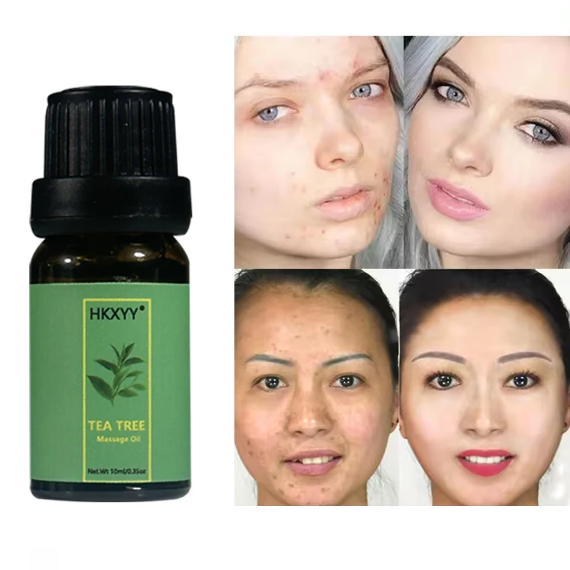 Private Label Oem Custom 10ml Essential Oil For Body Comfort Relax Body Lavender Tea Tree Peppermint Massage Oil