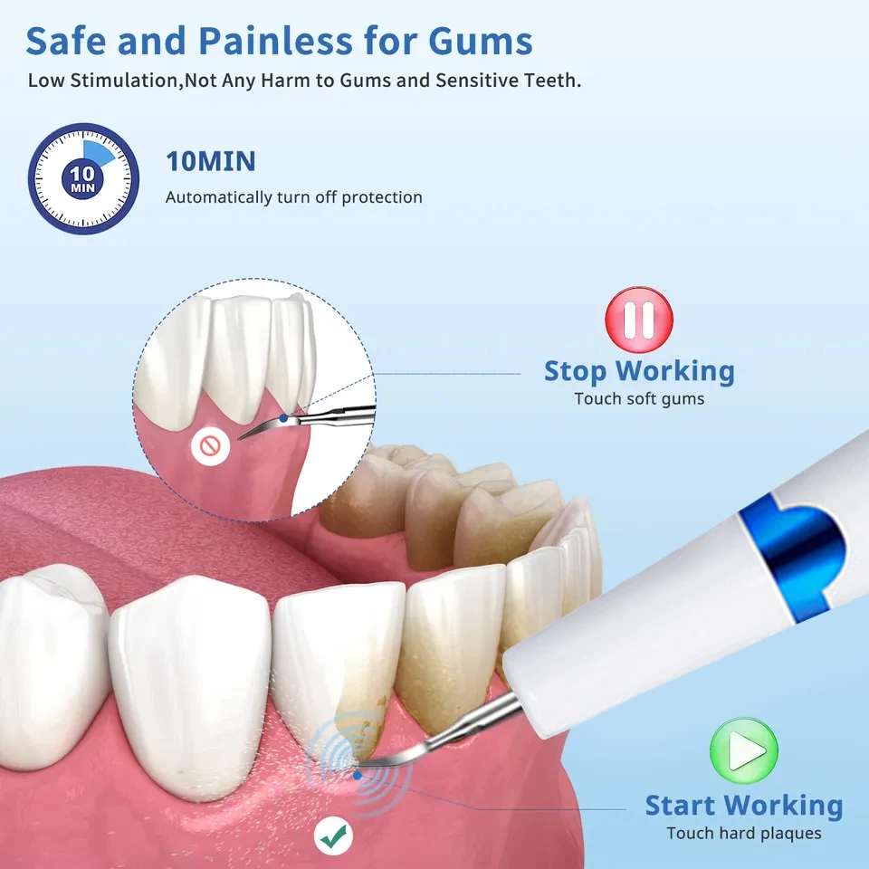 Electric Ultrasonic Teeth Cleaning Set for Overseas Audiences & Pet Clean Delights - Eliminate Calculus and Plaque, Whiten Teeth