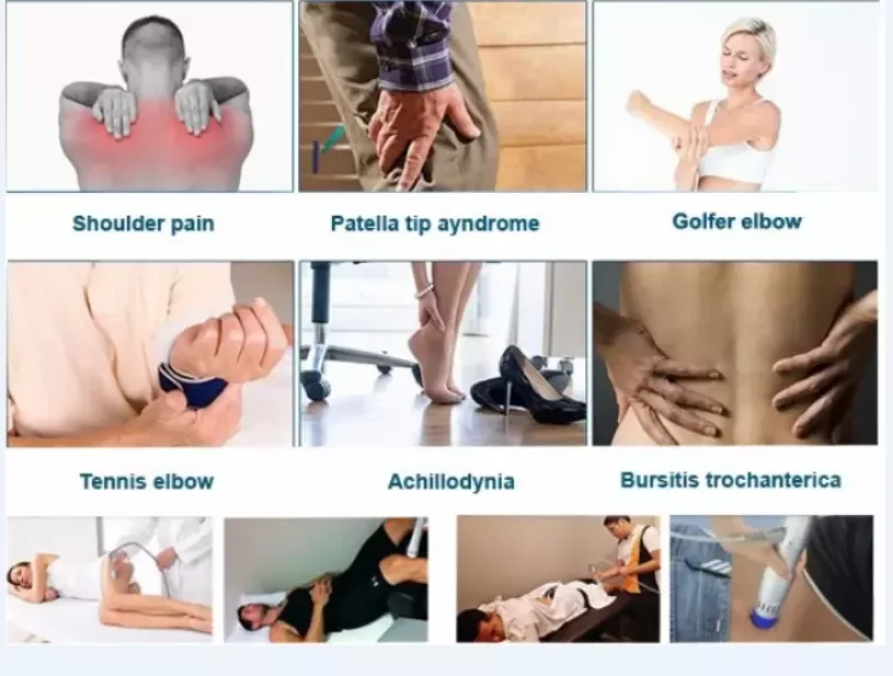 Portable Shockwave Therapy machine shock wave therapy physical therapy equipments for pain relief