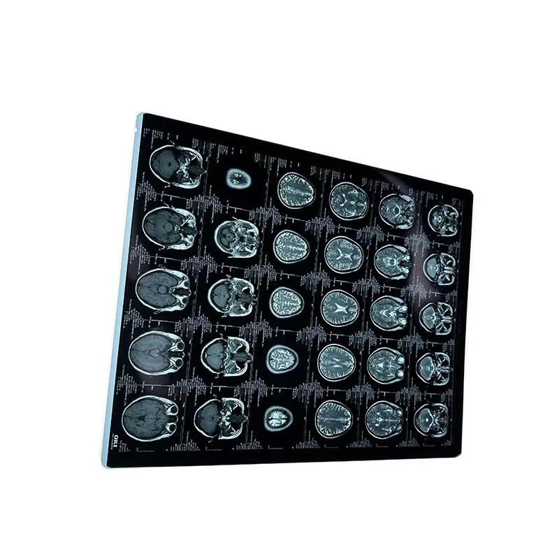 Thermal X-ray film 8X10 inch 11X14inch 14X17inch Stable  work on FUJI AGFA printer Use hospital