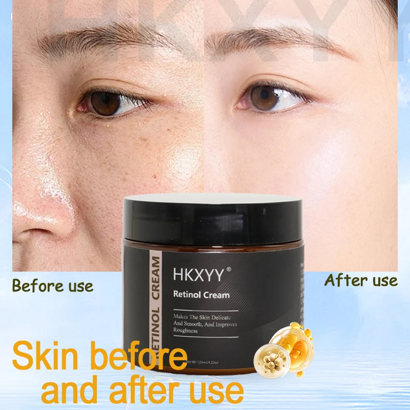 Anti Aging Hydrating Hyaluronic Serum Acid Resurfacing Retinol Serum Skin Renewing Retinol Serum