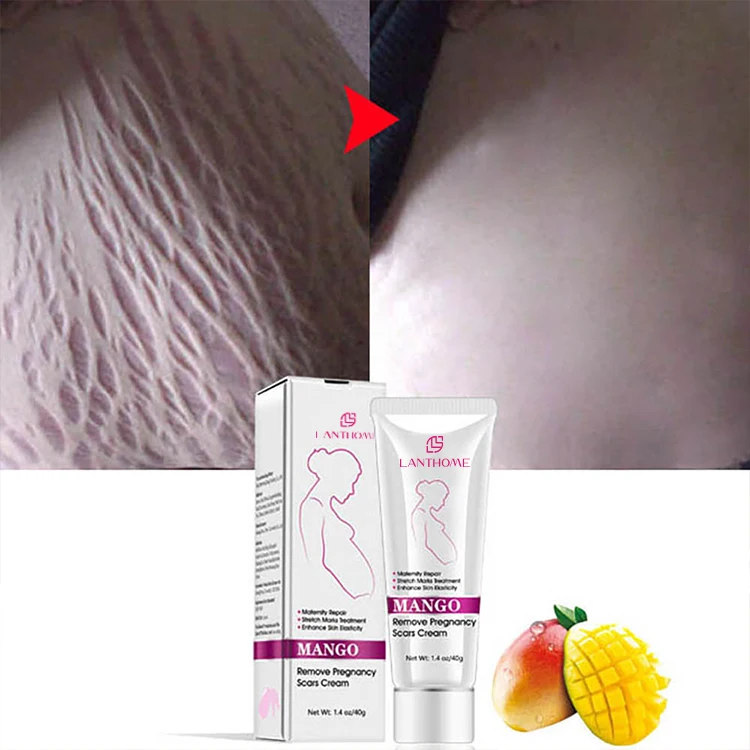 Make Your Own Body Skin Care Skin Repair Remove Clear Pregnancy Scar Removal Stretch Mark Cream