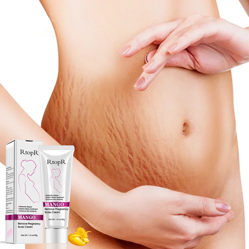 
Amazon Hot Private Logo Enhance Skin Elasticity Maternity Repair Stretch Marks Removal Cream 