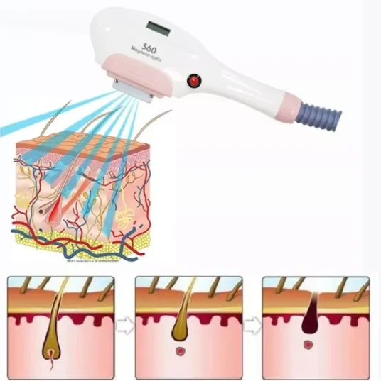 360 Magneto E-light Opt Ipl Hair Removal Laser machine Laser Hair removal for Hair Removal,Skin Rejuvenation
