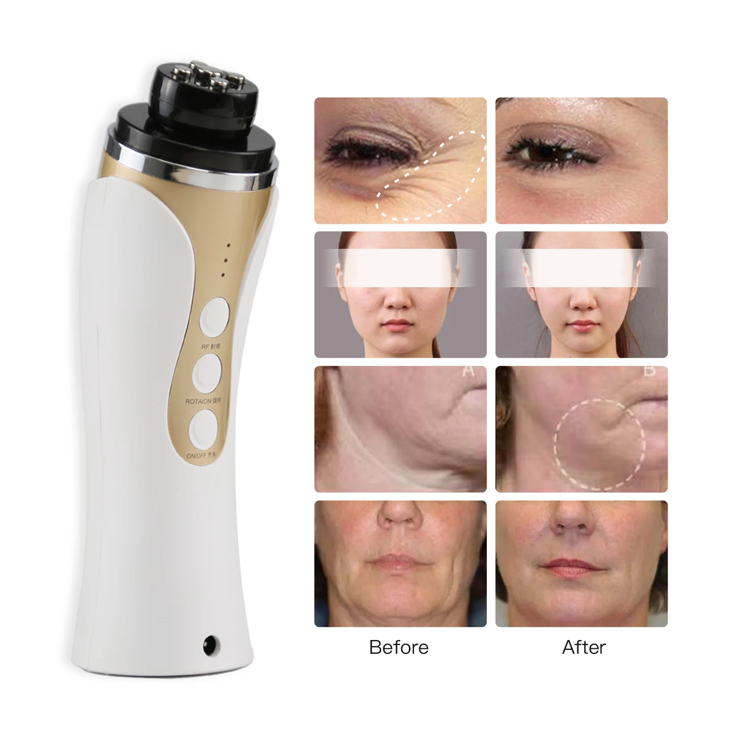 Free Samples V Shape Face Lifting RF Facial Beauty Device Machine Face Rejuvenating Anti-Wrinkle Home Use RF Beauty Equipment
