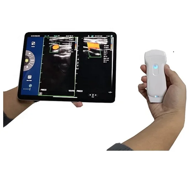 MC27 Inexpensive CE high quality 3 in 1 wifi&USB ultrasound probe with convex, linear and cardiac functions