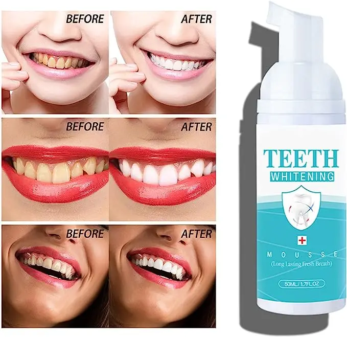 Teeth Mouthwash Whitening Toothpaste Foam,Ultra-fine Mousse Foam Whitening Products Deep Cleaning Toothpaste