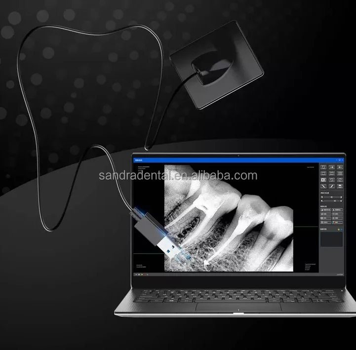 Самый популярный зубоврачебный рентгеновский Датчик CE аппарат портативный цифровой стоматологический датчик