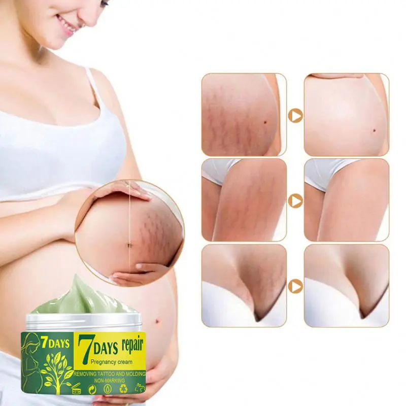 
Pregnant Women Stretch Marks All Natural Stretch Mark Cream Anti Scar Repair Cream 