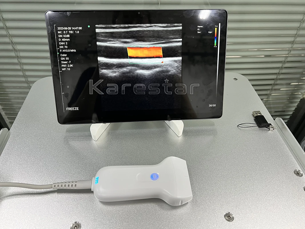 Handheld medical wifi wireless ultrasound probe scanner machine portable animals use wireless probe