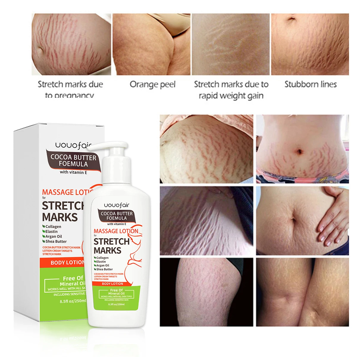 Manufacturer Free sample stretch marks removal cream