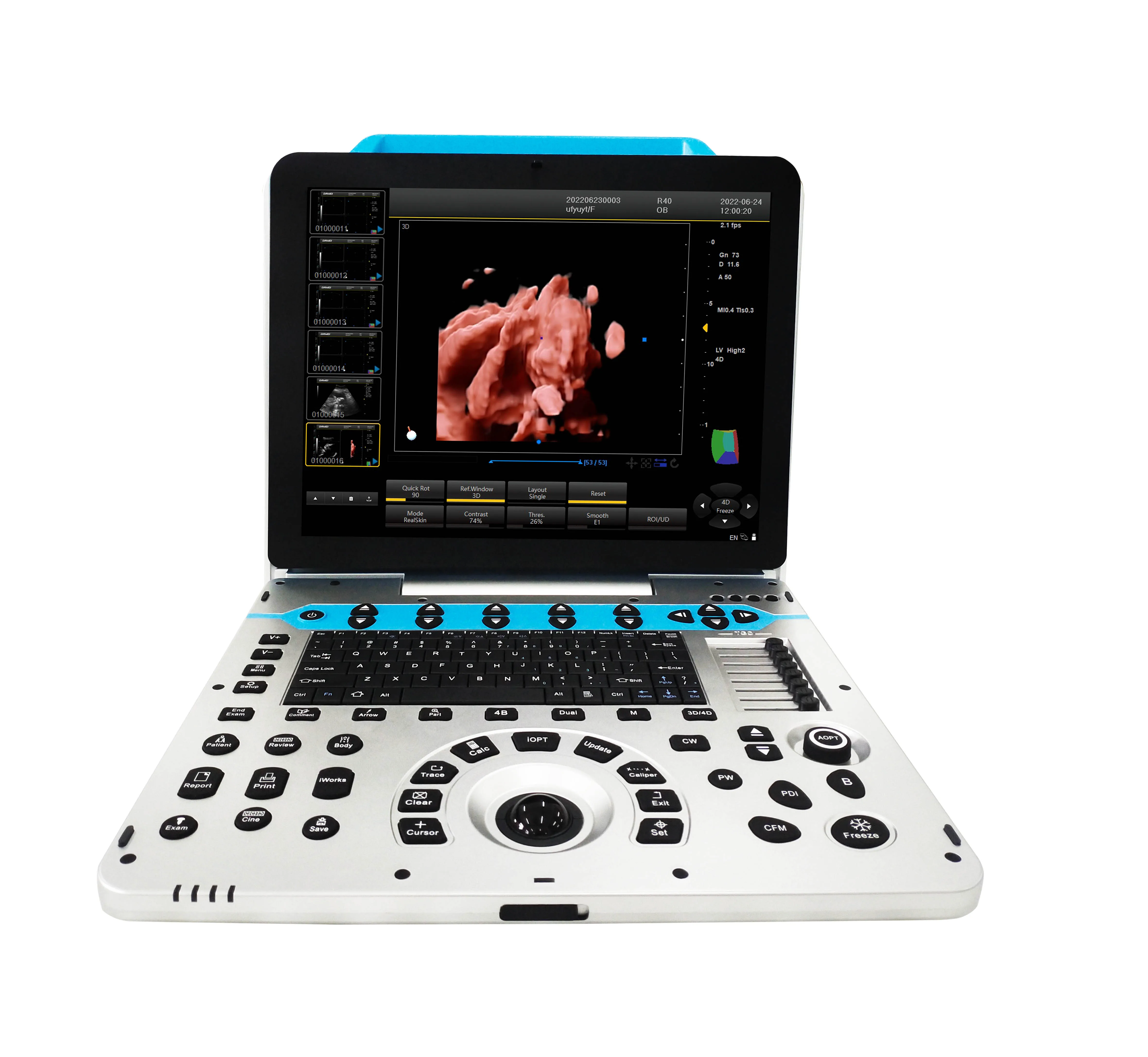 12.1 inch 4D 3D  Diagnostic Ultrasound Machine color doppler ultrasound machine