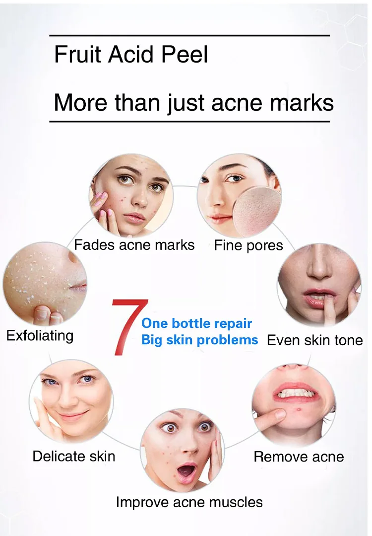 2021 HOT Selling the ordinary aha 30% bha 2% peeling solution Anti Acne Remove blackheads Smooth skin aha serum