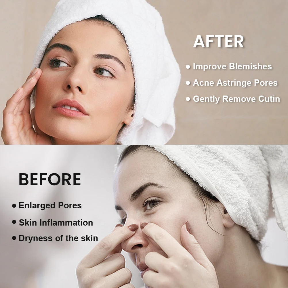 OEM/ODM Glycolic Acid 7% Toner 240ml Glycolic Acid Toning Solution  Exfoliating Toner Suitable for Women and Men