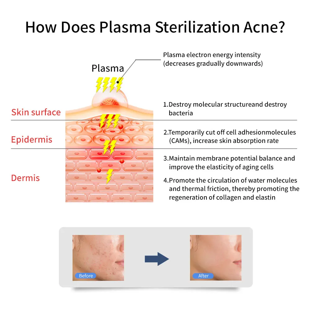 Плазменная Ручка для домашнего ухода за кожей самые популярные товары Новые поступления устройство подтяжки лица Самые продаваемые косметические устройства