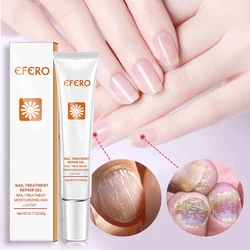 Feet Toe Care Treatment Foot Nail Fungus Removal Gel Anti Infection Paronychia Onychomycosis Fungal Nail Repair Essence Serum