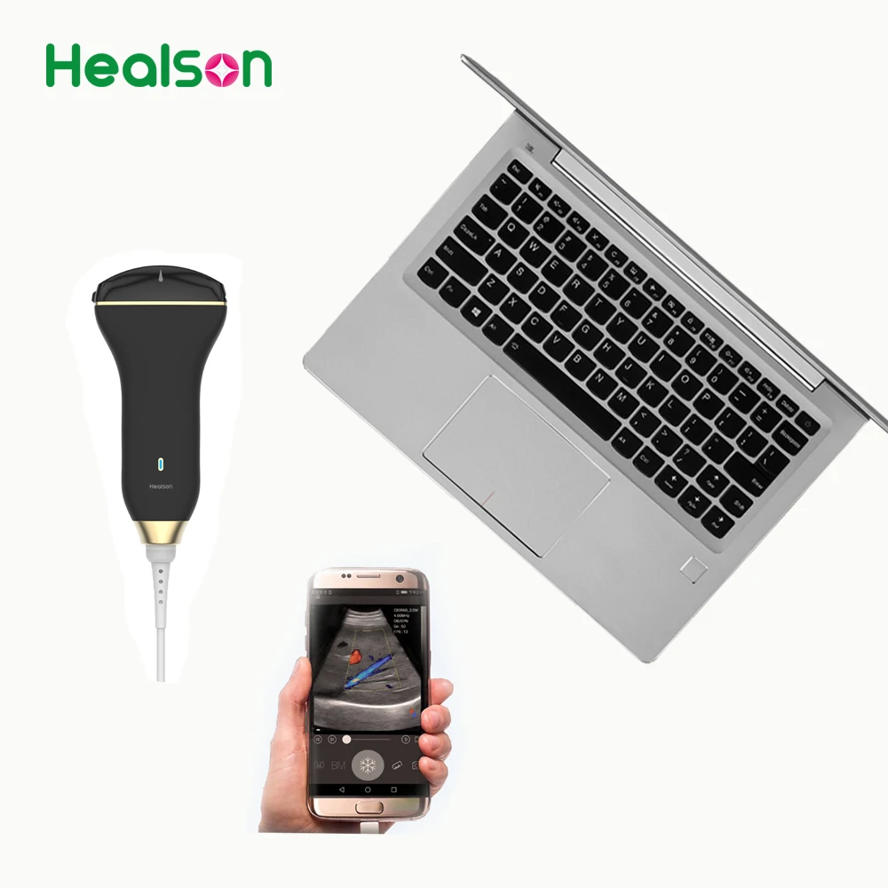  Ручной ультразвуковой допплер Healson C30 uprobe выпуклого цвета для смартфона