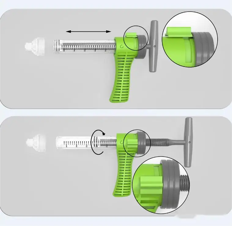 Orthocare Orthopedic Surgery CE EO Sterile PKP Transparent & Light Green Bone Cement Injector