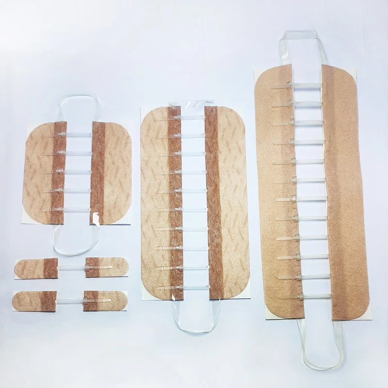 Chinese Factory Direct Wholesale High Pulling Force 1.5 CM Wound Closure Strips  Alternatives For Wound Sutures