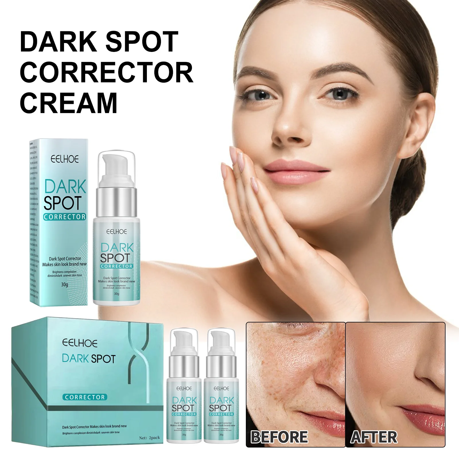 Organic Whitening Anti Freckle Face Care Cream For Pigment Melasma Acne Pimples Dark Spot Corrector with Support customization