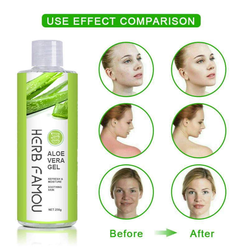 
Customized private logo skin lightening smoothing gel face cream natural organic pure aloe vera gel for face care 