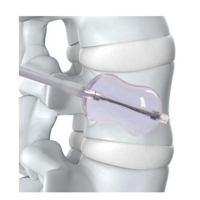 High Quality Vertebral Perforator PVP  Thoracic Layer by Layer Puncture Guide Needle