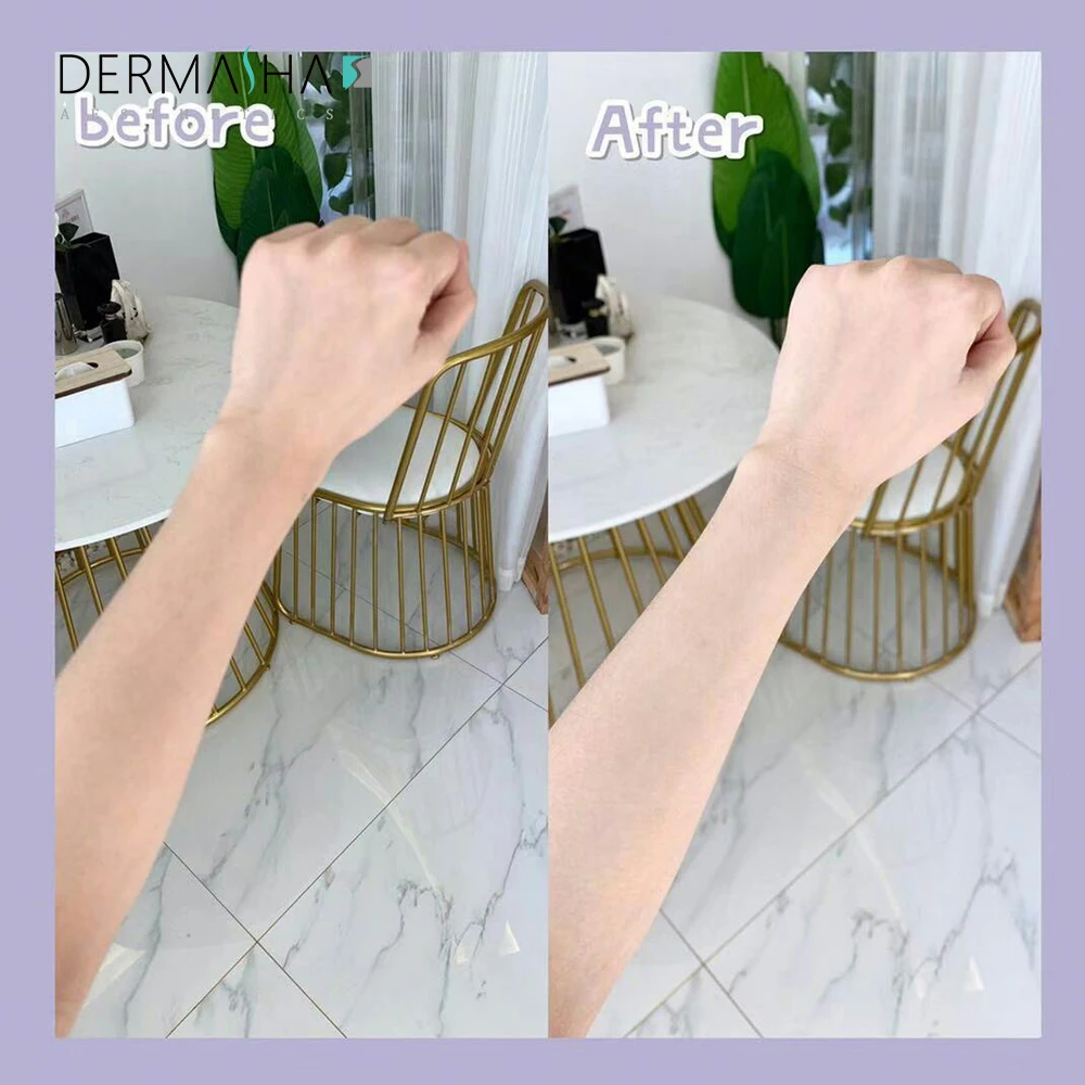 Red light bed NIR LLLT LED Photo biomodulation Therapy Bed Pdt muscle pain high blood pressure, Beauty skin care