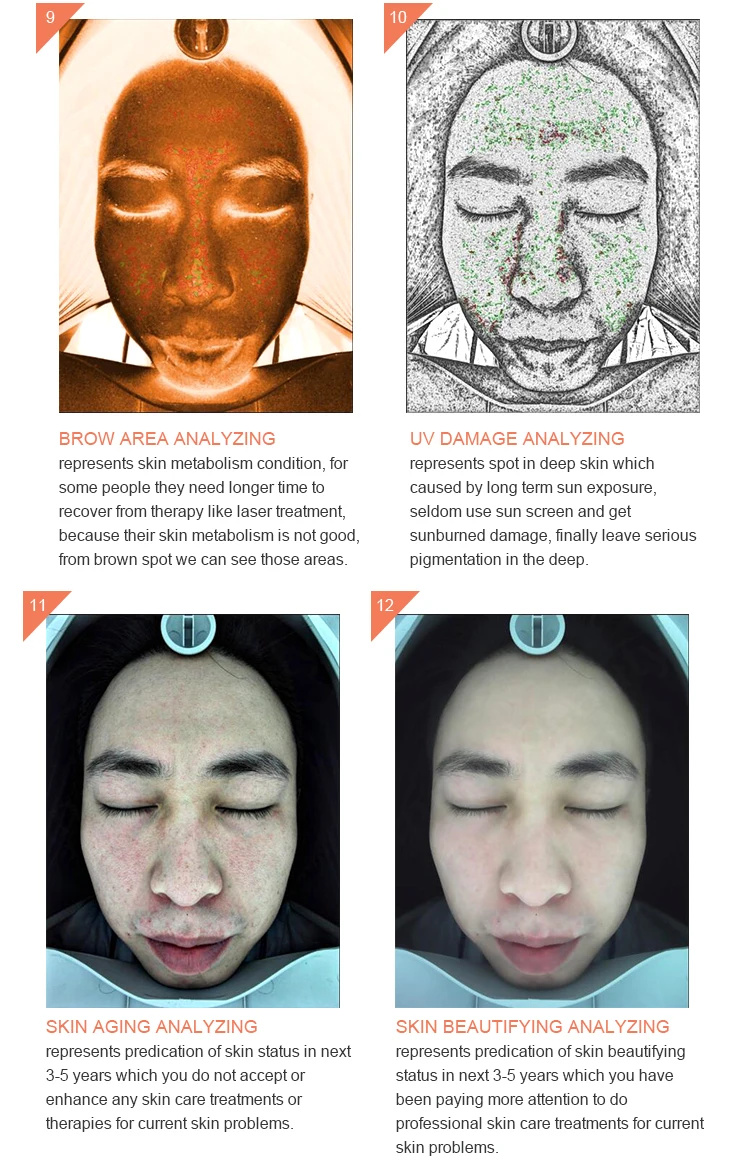 Top Selling 3d Skin Test Health Diagnosis Face Visia Analyzer Machine Face Analyzer Machine