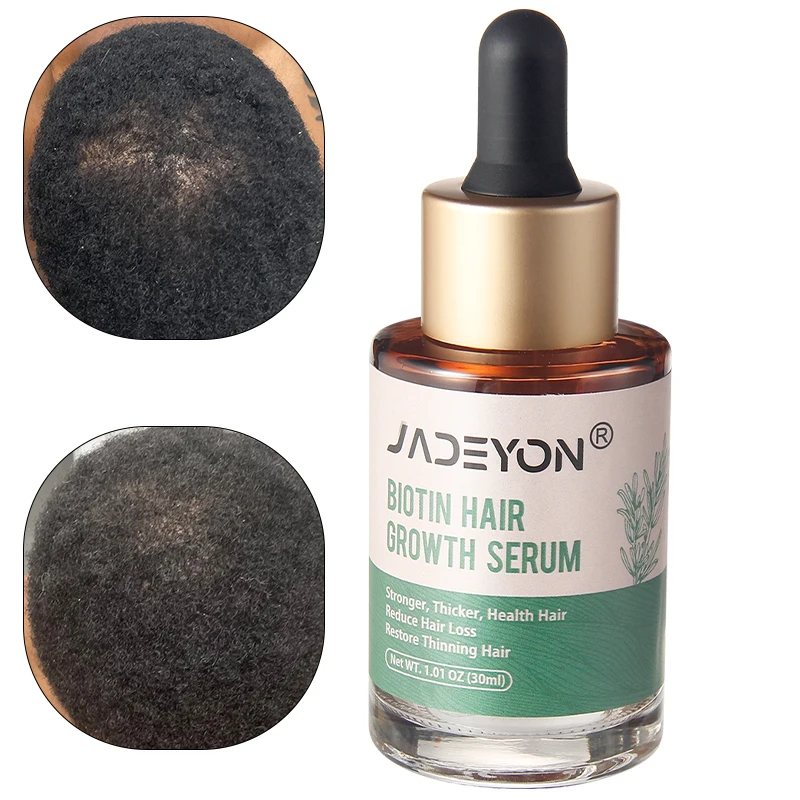 Распродажа натуральные растительные эфирные масла для роста волос питательное детское масло на заказ сыворотка лечение