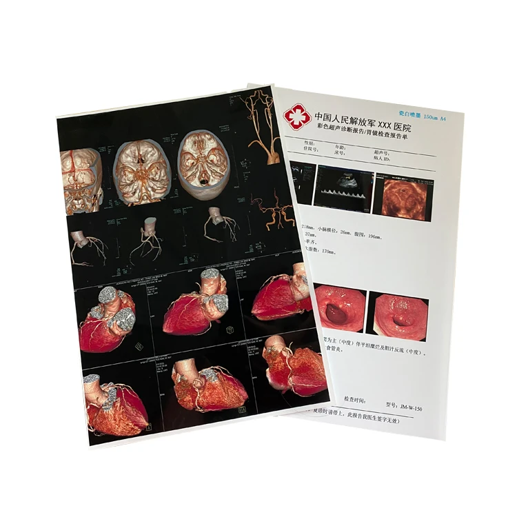 A4 White Ultrasound Inkjet Printable Dicom Medical Film
