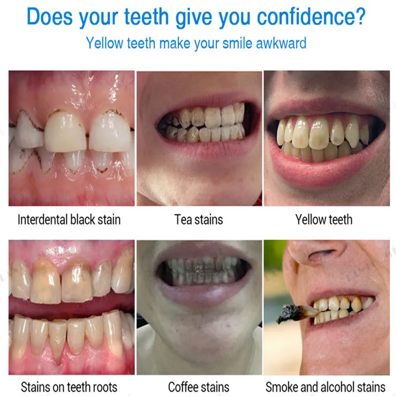 Lanthome 4ml Interdental Black Coffee Smoke Alcohol Tea Stains Yellow Teeth Removing Pen Whitening Breath Freshening Essence