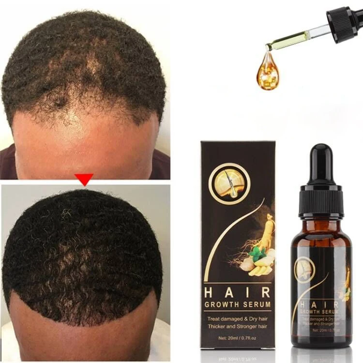 Hair Care Treatment Serum Organic Natural Ginseng Essential Oil Promote Hair Growth Oil For Woman