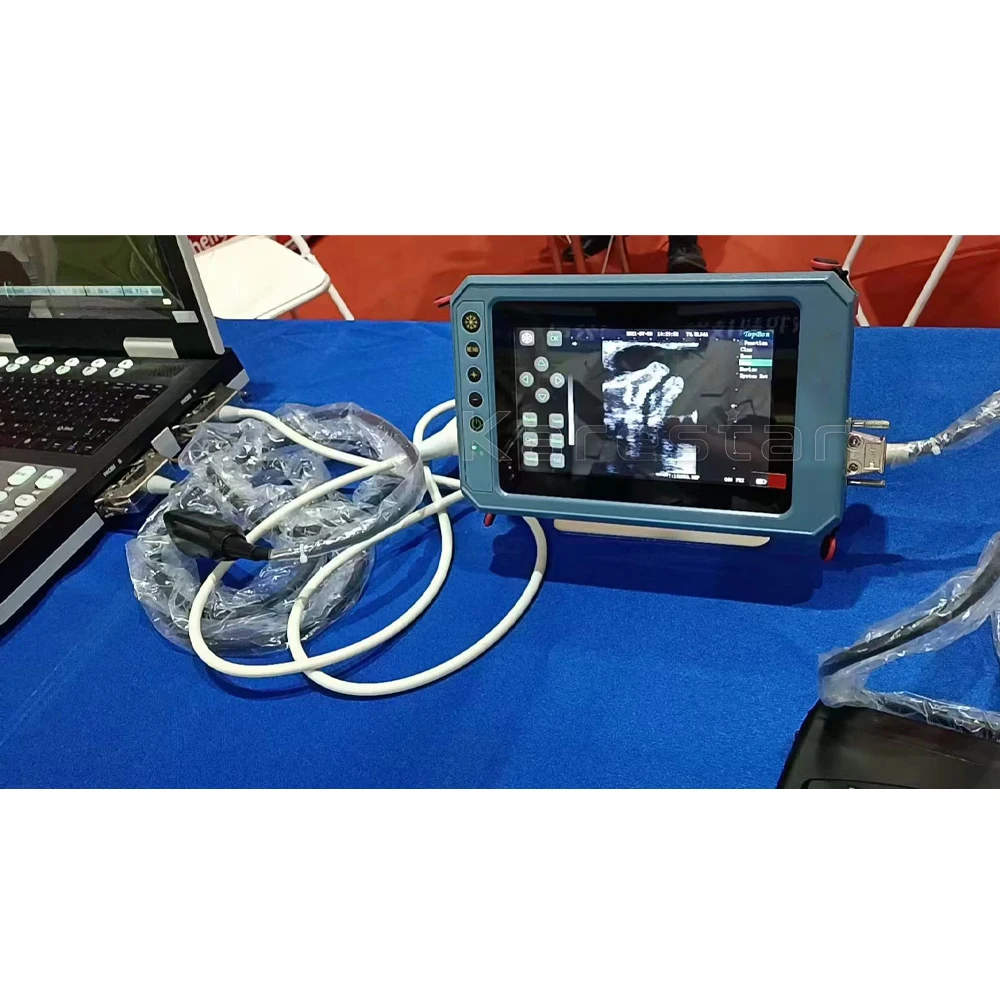 Medical K-S300 Handheld Full Digital Portable Veterinary Ultrasound Scanner
