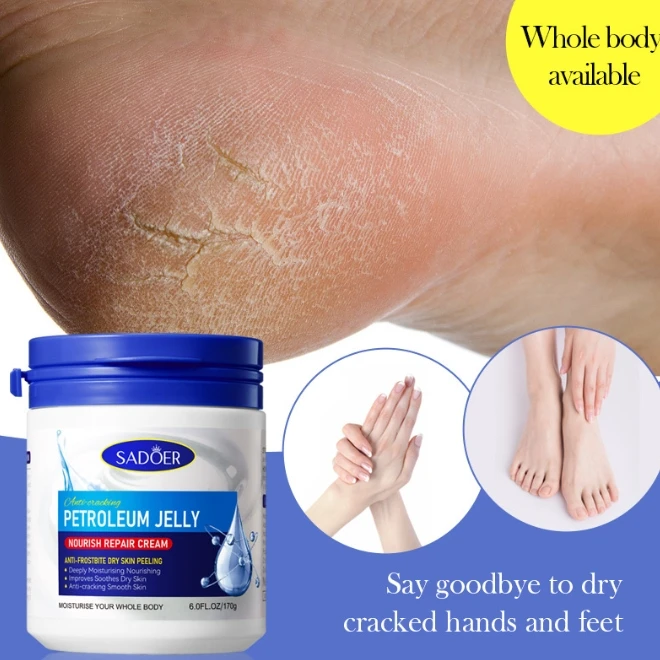 Moisturizing and Repairing Cream PETROLEUM JELLY HYDRATE VITAMIN B5 VITAMIN C SQUALANE for the Whole Body